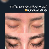 سرم تقویت مژه و ابرو
