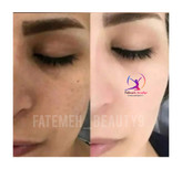 ژل کرم سفید کننده پوست رویال