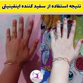 قوی ترین سفید کننده دنیا